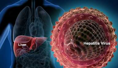 hepatitis-
